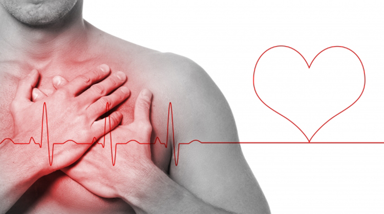 FACTOR DE RIESGO CARDIOVASCULAR